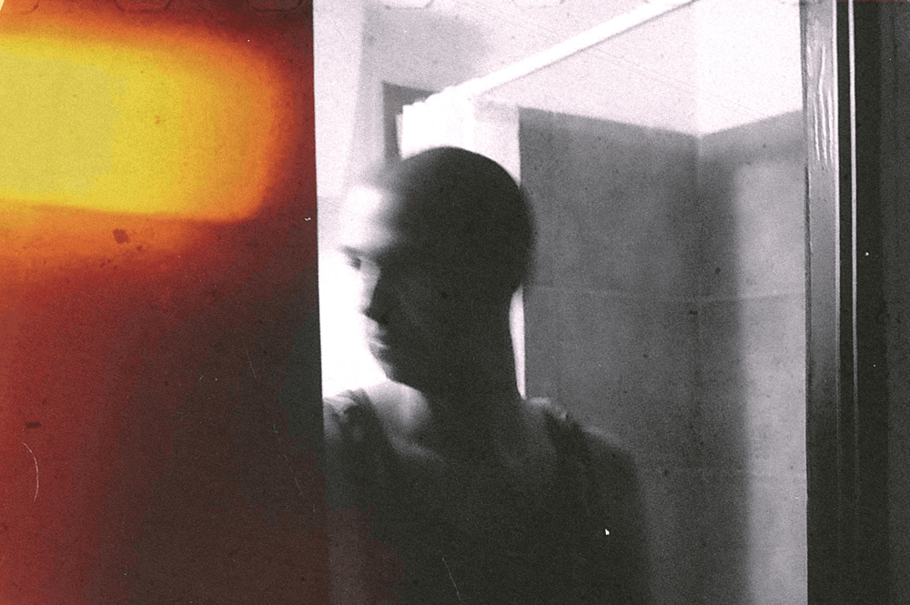 hairline creeping back